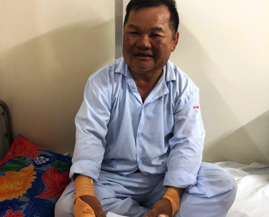 Kiểm lâm viên Hà Văn Thạch kiên cường chống “giặc lửa” và không may bị bỏng phải nhập viện điều trị 