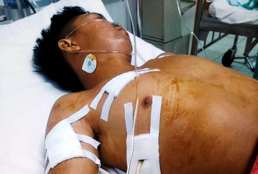 Anh Nguyễn Lầm là một trong hai nạn nhân bị Hưng đâm trọng thương dù không hề có mâu thuẫn từ trước chỉ trong một đêm