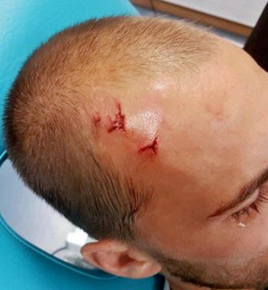 Cầu thủ Sporting Lisbon bị tấn công ngay trên sân tập