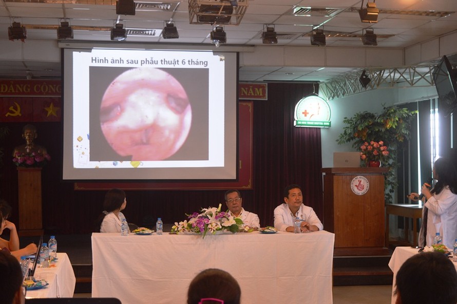 Công nghệ phẫu thuật bằng laser được bệnh viện Tai Mũi Họng áp dụng.