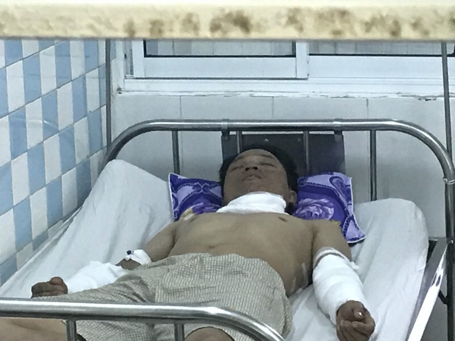 Công nhân bị bỏng đang điều trị tại bệnh viện Đà Nẵng. 