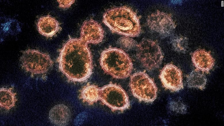 Virus SARS-CoV-2 - một loại virus corona gây bệnh COVID-19. Ảnh: CNN