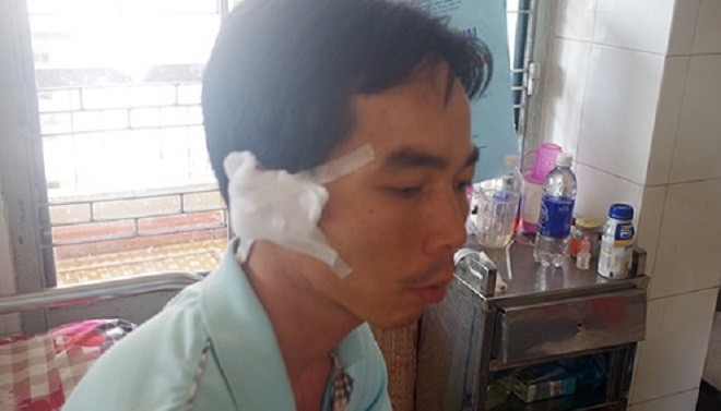 Anh Luận đang điều trị tại bệnh viện đa khoa tỉnh Đắk Lắk.