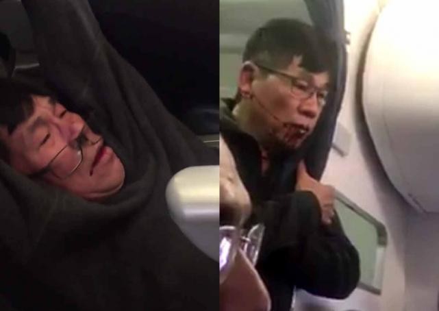Hình ảnh hành khách người Mỹ gốc Việt David Dao bị nhân viên an ninh lôi kéo thô bạo ra khỏi máy bay đang khiến cộng đồng mạng bức xúc.