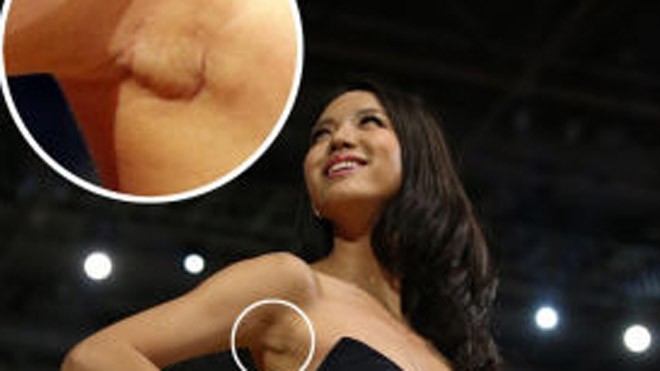 Cựu Hoa hậu Thế giới Trương Tử Lâm dính nghi án nâng ngực