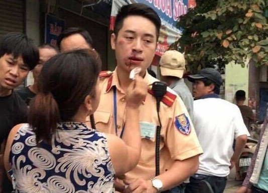 Khởi tố, bắt giam thanh niên “đấm” gãy răng CSGT Hà Nội