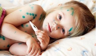 Bệnh ngoài da do nhiễm virus thường gặp ở trẻ em.