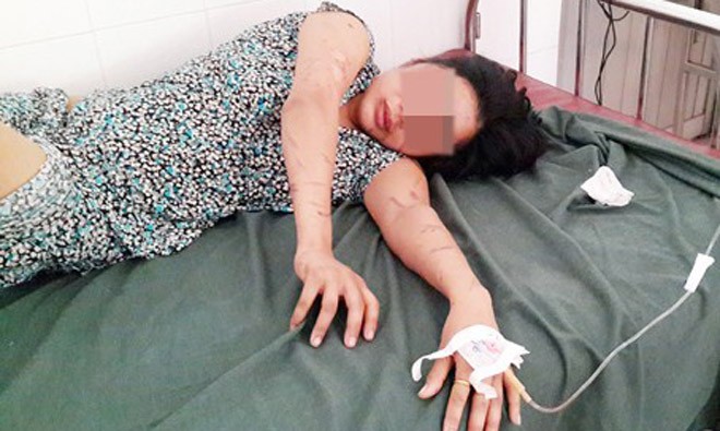 Nạn nhân Nguyễn Thị Kết điều trị tại bệnh viện.