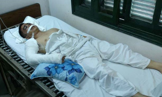 Trung úy Hoàng bị đa chấn thương, đang cấp cứu tại Bệnh viện Việt Đức. Ảnh: Tuấn Nguyễn