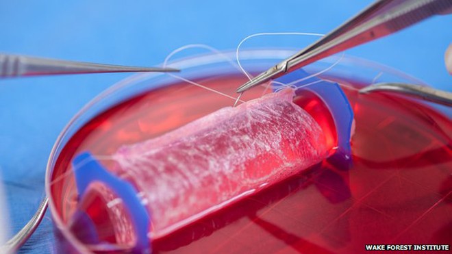 Trong phòng thí nghiệm, âm đạo được tạo ra từ khung tự phân hủy và tế bào của chính bệnh nhân. Ảnh: BBC