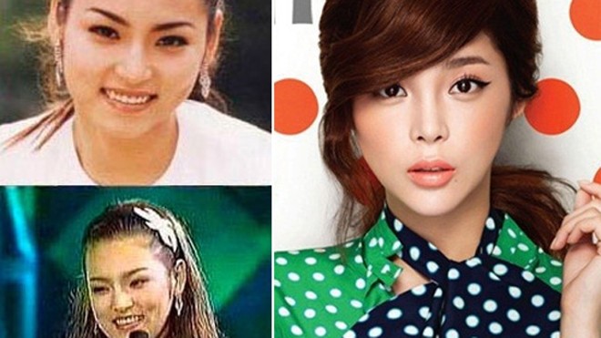 Hình ảnh cựu Á hậu Hàn Quốc trước và sau “dao kéo”