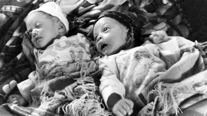 Hai em bé song sinh đặc biệt: Bé sau cách bé trước 29 ngày.