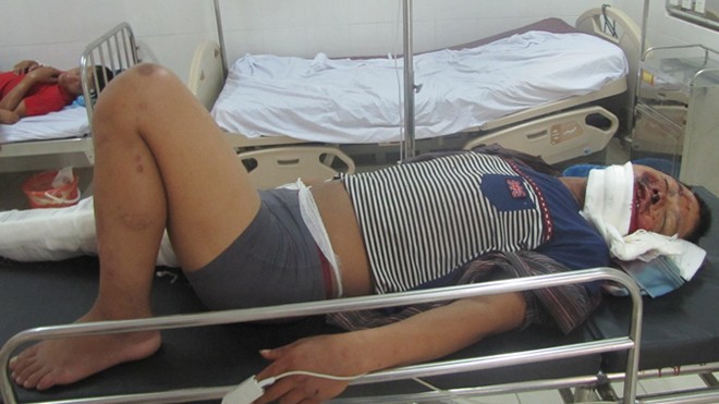 Công nhân bị thương đang điều trị tại Bệnh viện Đa khoa Hà Tĩnh 