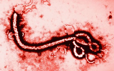 Vi rút Ebola gây sốt xuất huyết Ebola