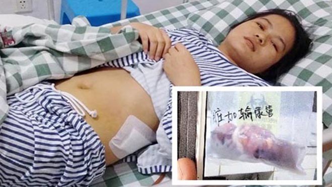 Cô Wai Jianmin nghi ngờ bệnh viện có liên quan tới đường dây buôn bán nội tạng. Ảnh: shanghaiist