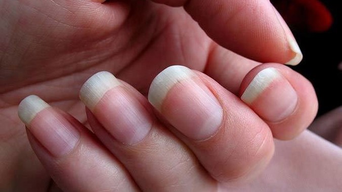 Móng tay có thể phát triển nhanh hơn so với móng chân tùy theo đặc điểm giới tính, chế độ ăn uống hay di truyền. (Ảnh minh họa: Flickr)