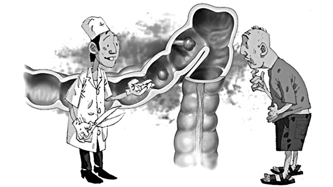 Viêm đại tràng - Điều trị ngay khi có dấu hiệu