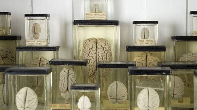 Các bộ não được bảo quản trong bình đựng formaldehyde thường được sử dụng trong các hoạt động nghiên cứu và giảng dạy. Trong ảnh là mẫu vật được trưng bày trong một bảo tàng ở London, Anh. 