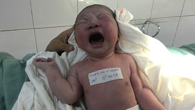 Sản phụ Nguyễn Thị Tú Uyên (20 tuổi) ở quận 7, TP HCM, nhập viện chiều 31/12/2014. 23h30 chị được đưa vào phòng sinh và đúng 0h ngày 1/1/2015 vượt cạn thành công.