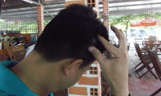 PV Thanh Lâm chỉ vào vùng đầu bị hành hung.
