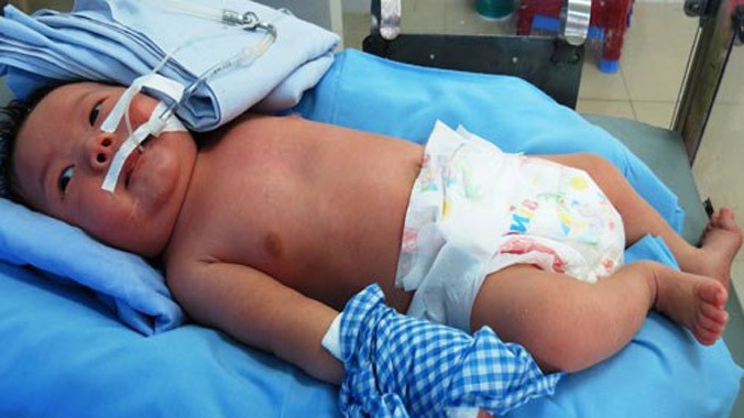 Cháu bé gần 1,5 tháng tuổi bị bỏ lại bệnh viện. Ảnh: Thanh Niên