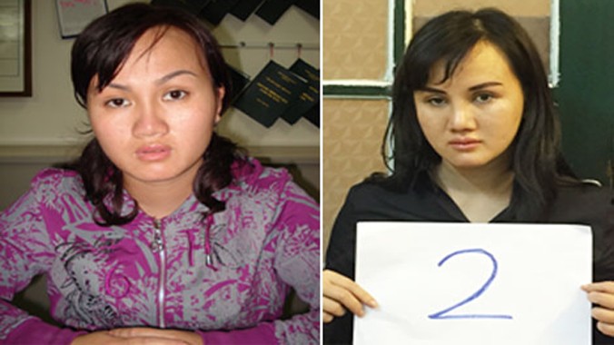 Nguyễn Phượng Ly trước và sau khi phẫu thuật thẩm mỹ.