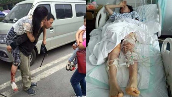 Cô Yuan Yan được đưa tới bệnh viện sau khi bị hai con chó dữ tấn công .