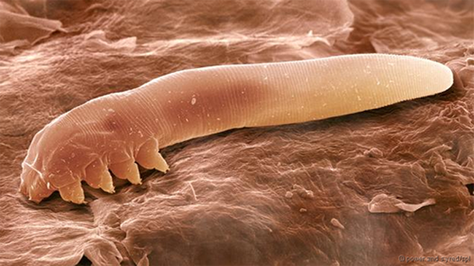 Rận D.follicurum quan sát dưới kính hiển vi điện tử, có thân hình thuôn dài sống sâu, 8 chân ngắn gần đầu. Ảnh: BBC.