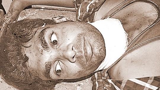 Anh Rajveer Singh đã tỉnh lại trong bệnh viện. Ảnh: Hindustan Times.