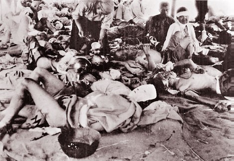 Nạn nhân bom nguyên tử tại khu lều ven sông Ota.
