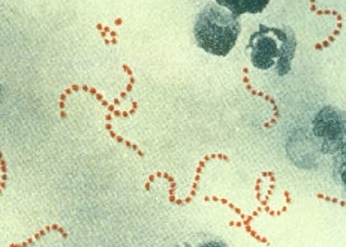 Liên cầu khuẩn. Ảnh: CDC.