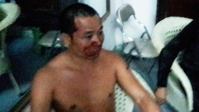 Phụ xe Lã Hồng Quang bị truy sát chảy máu đầu.