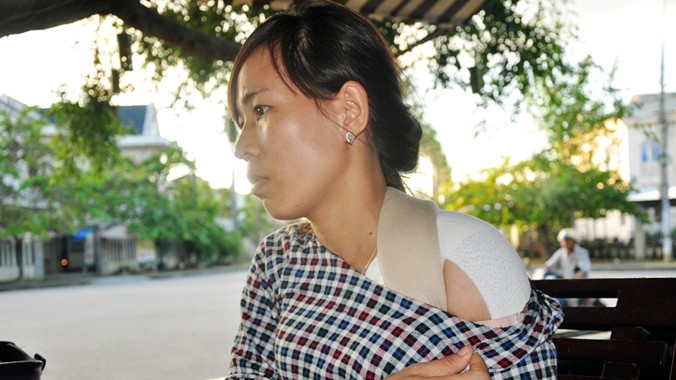 Chị Nguyễn Thị Hóa với vết thương mà chị tố là bị anh Tú đánh.