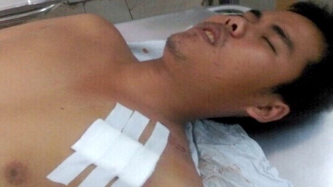 Đồng chí Nguyễn Thương Hoài hiện đang được điều trị tại bệnh xá công an tỉnh Tiền Giang.