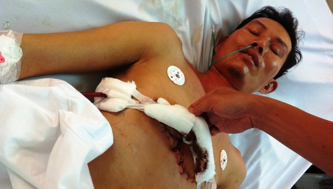 Vết thương của bệnh nhân Trần Trường Giang lành và sức khỏe hồi phục nhanh.
