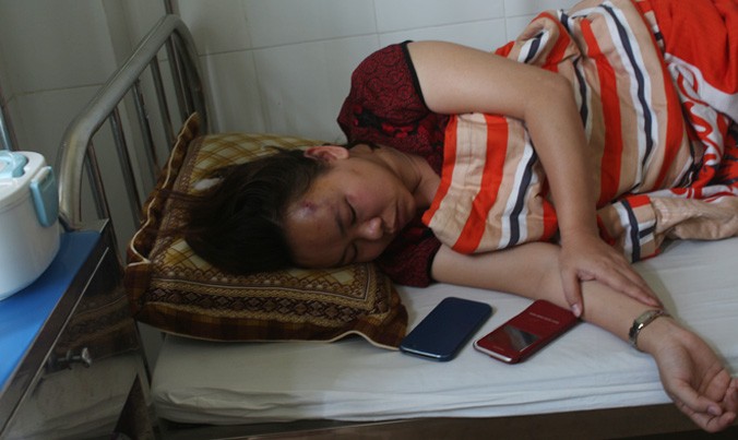 Chị Hà bị các đối tượng nhập viện với tình trạng đa chấn thương.
