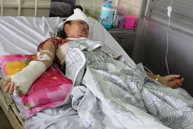 Hình ảnh các nạn nhân vụ sập lò gạch ở Lấp Vò, Đồng Tháp đang được điều trị tại Bệnh viện Chợ Rẫy TPHCM. Ảnh do bệnh viện cung cấp.