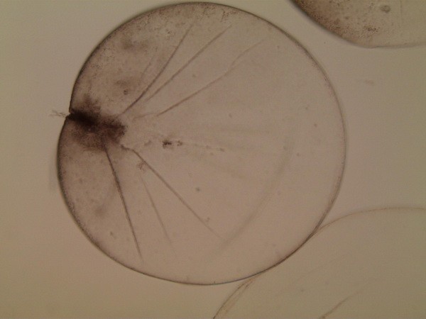 Hình ảnh loài Noctiluca scintillans soi dưới kính hiển vi. Ảnh: Bộ Tài nguyên và Môi trường.