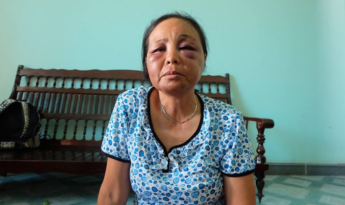 Bà Nguyễn Thị Phúc kể lại sự việc với phóng viên.