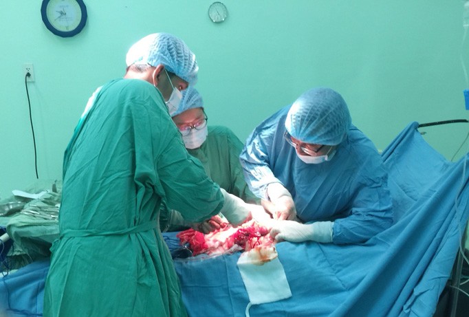 Các bác sĩ tiến hành phẫu thuật cắt khối u xơ nặng gần 6kg trong tử cung chị T. (Ảnh bệnh viện cung cấp).