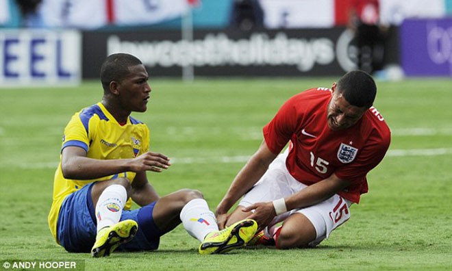 Oxlade-Chamberlain dính một chấn thương không hề nhẹ ở trận giao hữu với Ecuador.