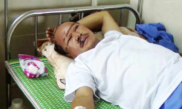 Đến can ngăn đối tượng say rượu, ông Quang đã bị tên này dùng đá đập vào đầu, hành hung phải nhập viện cấp cứu (ảnh:CAND) 