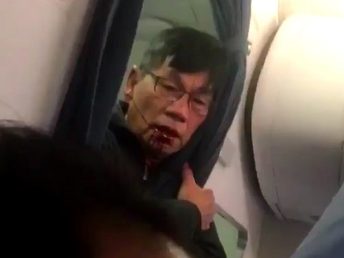 Bác sĩ David Dao bị thương sau khi bị lôi thô bạo khỏi máy bay của United Airlines hôm 9/4.