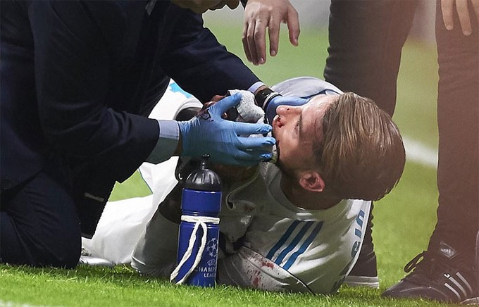 Cú đá của Lucas khiến Ramos bị vỡ mũi. Máu chảy ròng ròng từ cả hai lỗ mũi của thủ quân Real và buộc bác sĩ vào sân cấp cứu.