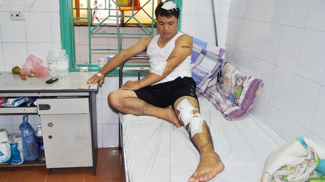 Anh Dương đang điều trị tại bệnh viện với 10 vết chém trên người.