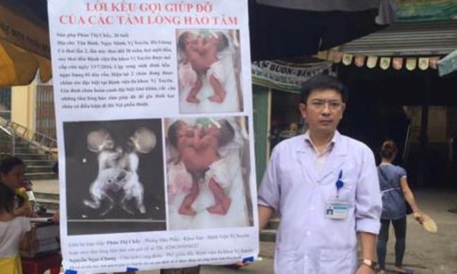 Bác sĩ Chung giương băng rôn giữa chợ để xin tiền nhằm cứu 2 bé sơ sinh dính liền.