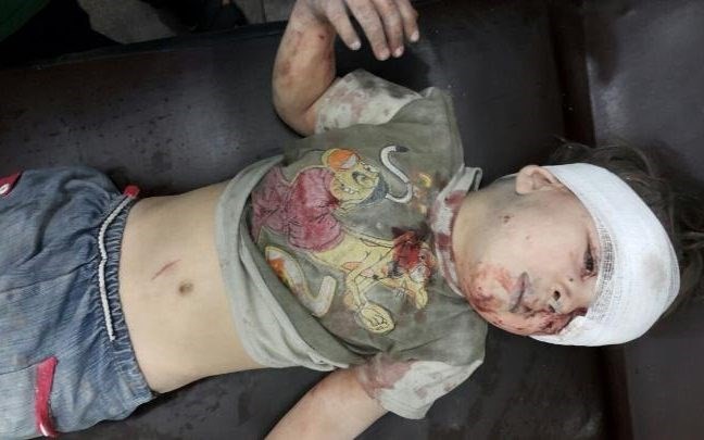 Báo chí Phương Tây đăng tải hình ảnh cậu bé Omran, 5 tuổi, được cứu khỏi tòa nhà đổ nát ở khu vực bị phong tỏa tại Aleppo. (Nguồn: Telegraph)