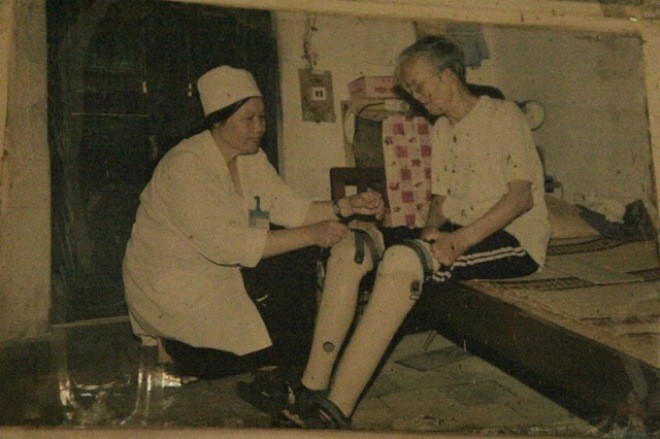 Chị Nguyễn Thị Xuân đeo chân giả cho bệnh nhân.