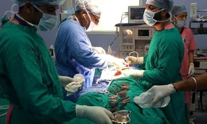Ca phẫu thuật lấy 40 con dao khỏi dạ dày nam bệnh nhân ở Ấn Độ.
