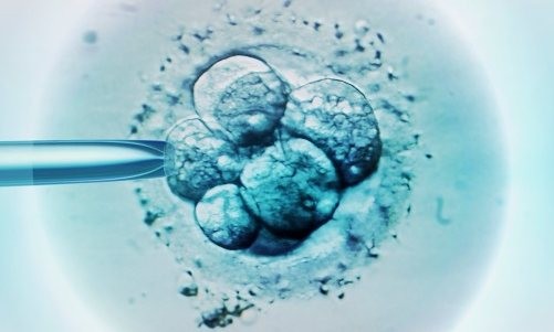 Quá trình cấy tinh trùng và tế bào trứng trong thụ tinh ống nghiệm. Ảnh: Getty Images